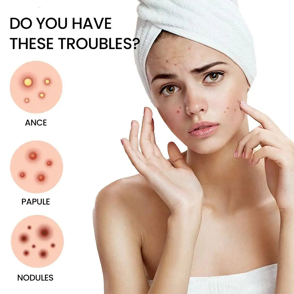 200pcs Invisible Acne Pimple Patch Set - Fast Healing & Absorbing for Men & Women