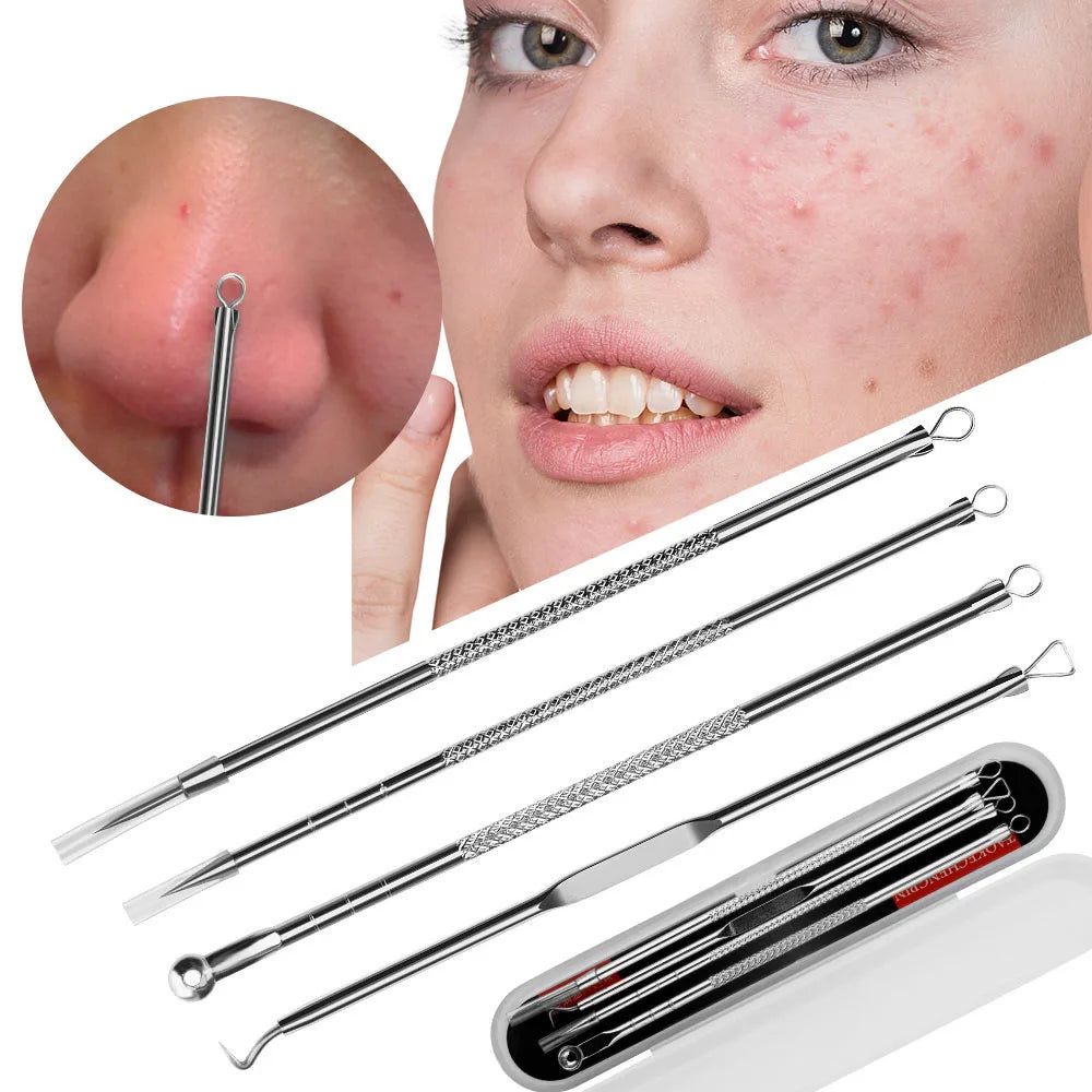 4Pcs Blackhead Remover Kit | Stainless Steel Acne & Pimple Extractor Tools
