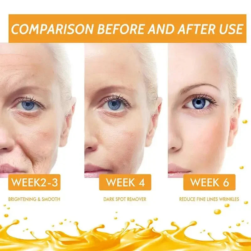 Vitamin C Whitening Serum Face Remove Dark Spots Freckles Fade Melanin Retinol Anti-wrinkle Essence Brightening Korean Skin Care