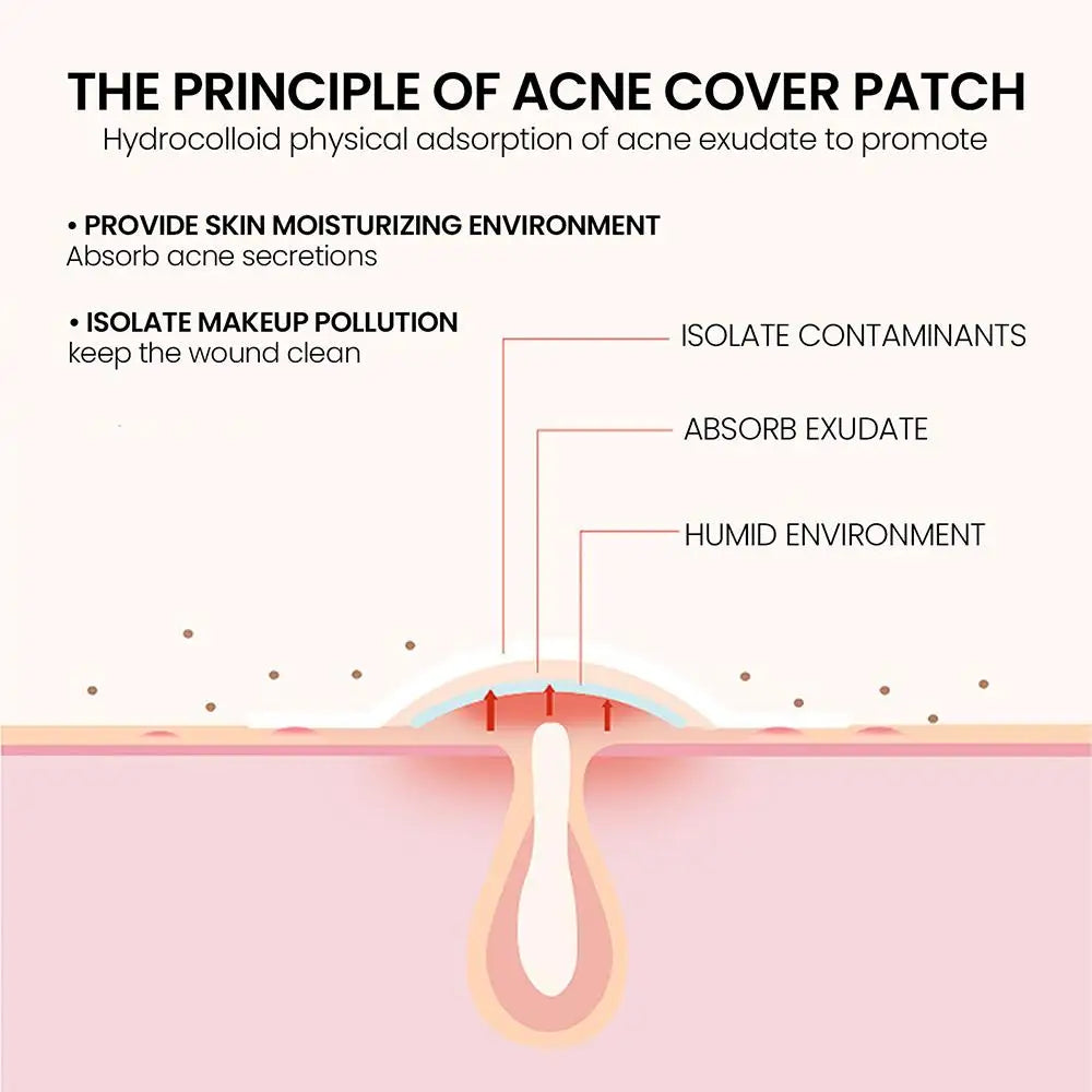 200pcs Invisible Acne Pimple Patch Set - Fast Healing & Absorbing for Men & Women