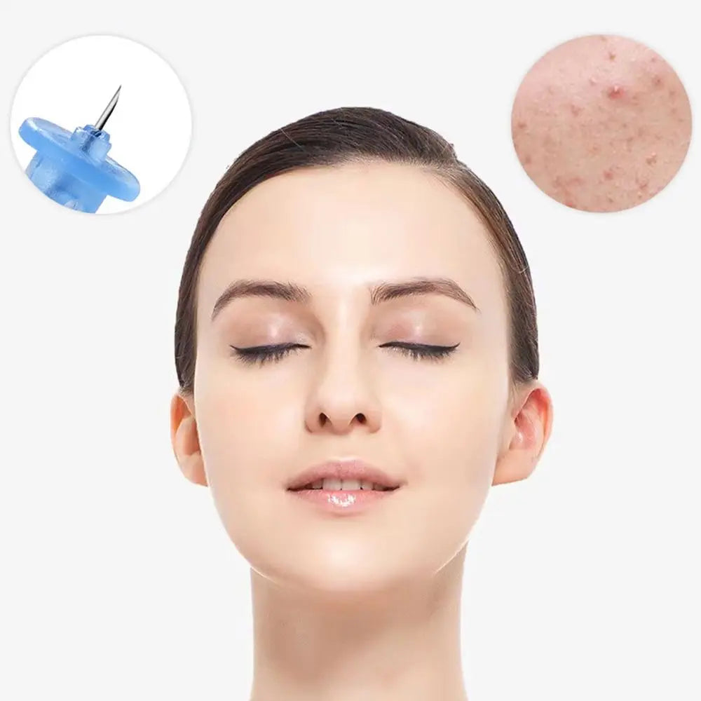 50pcs Disposable Acne Needles - Professional Blackhead & Blemish Remover Tool