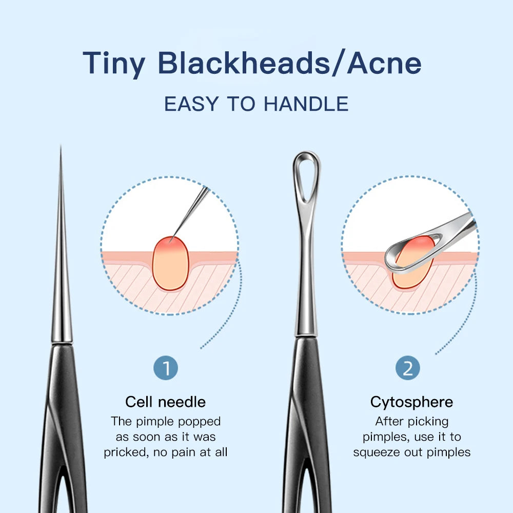 Acne & Blackhead Remover Tool - Deep Cleansing Needle