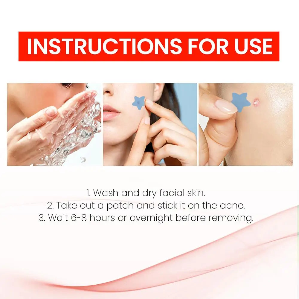 200pcs Invisible Acne Pimple Patch Set - Fast Healing & Absorbing for Men & Women