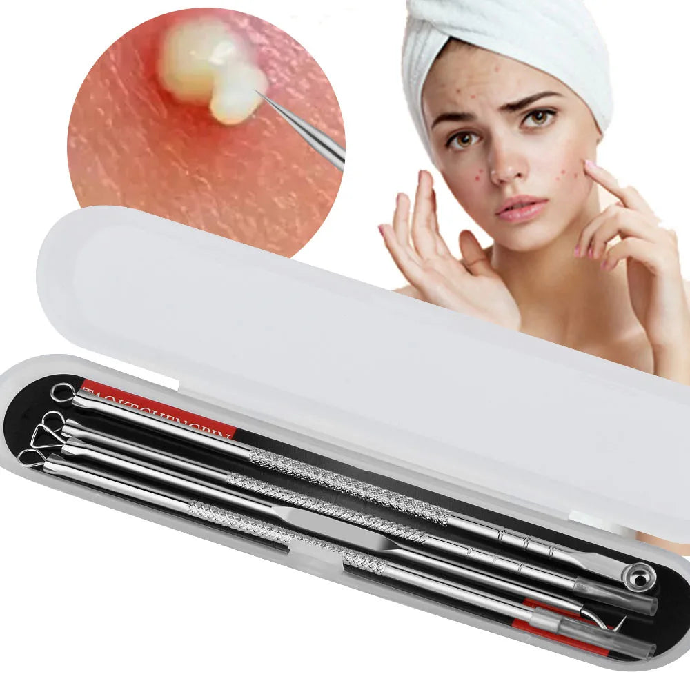 4Pcs Blackhead Remover Kit | Stainless Steel Acne & Pimple Extractor Tools