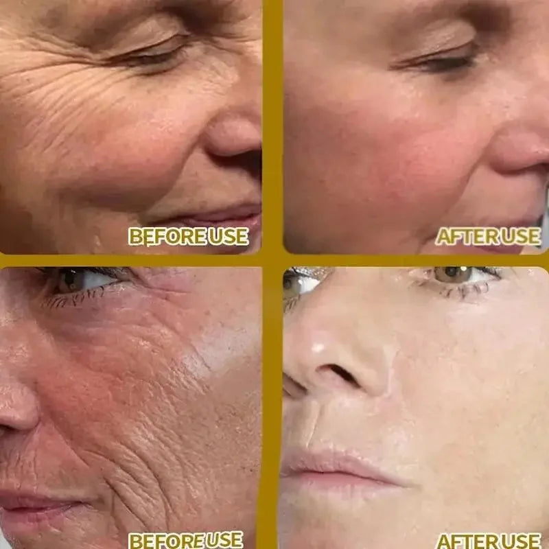 Vitamin C Whitening Serum Face Remove Dark Spots Freckles Fade Melanin Retinol Anti-wrinkle Essence Brightening Korean Skin Care