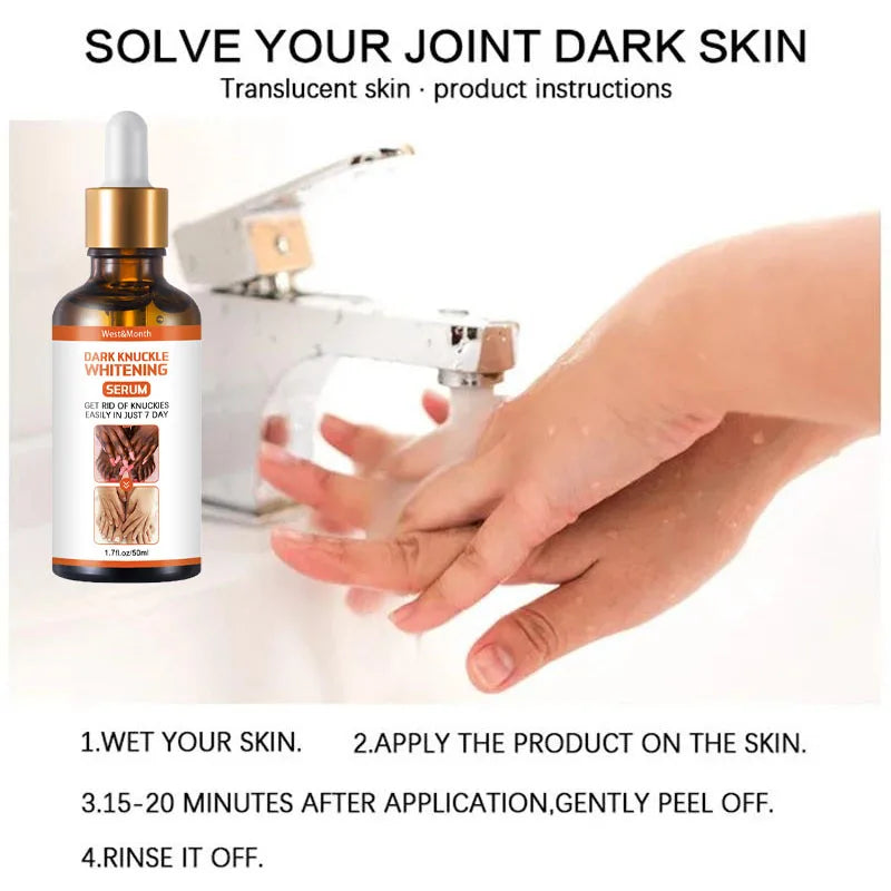 Dark Knuckles Fast Whitening Serum Hand Knuckle Elbows Knee Melanin Corrector Intense Stains Remover Products Beauty Care 50ml