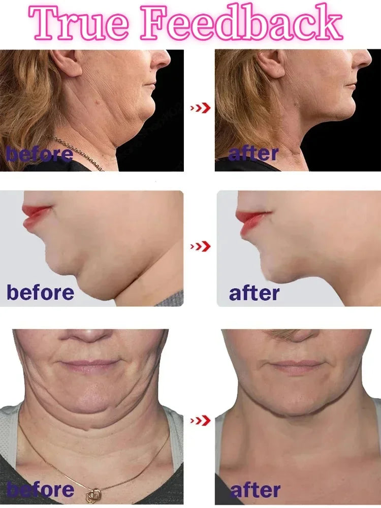 V-Shaped Slimming Face Cream Lift Firm Remove Double Chin To Create A Small V Face Anti-Aging Beauty Massage Products New