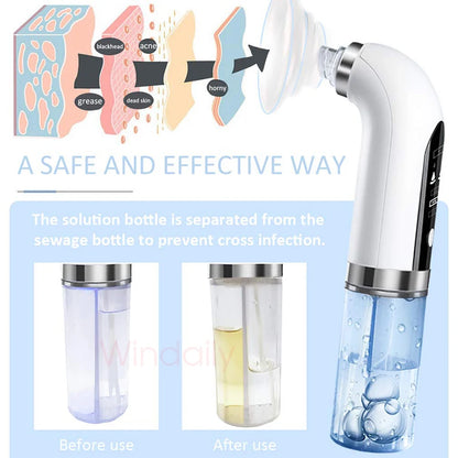 2023 USB Rechargeable Blackhead Remover: Electric Pore Vacuum & Facial Cleansing Machine