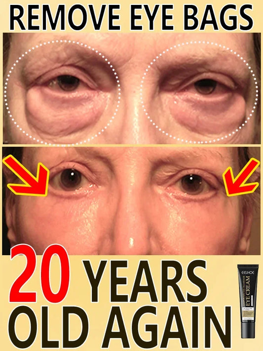 New Anti Wrinkle Eye Cream Remove Eye Bags Puffiness Lifting Firming Smooth Skin Care Moisturizing Instant Eye Massage Cream