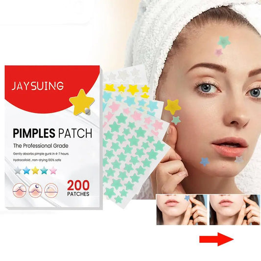 200pcs Invisible Acne Pimple Patch Set - Fast Healing & Absorbing for Men & Women