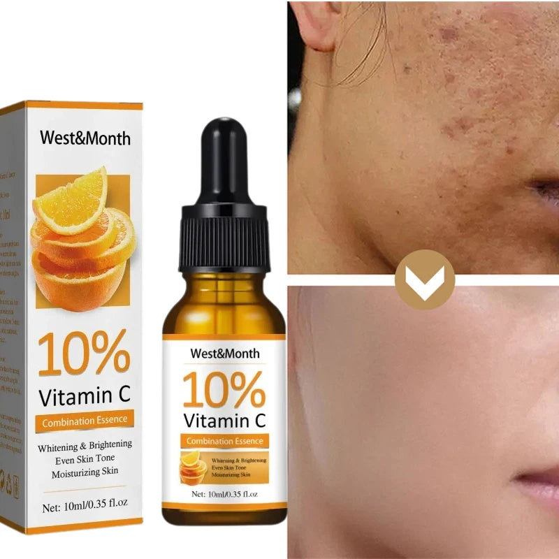 Vitamin C Face Serum Hyaluronic Acid Remover Dark Spot Sunburn Anti-oxidation Facial Whitening  Serum Smooth Bright Skin Care