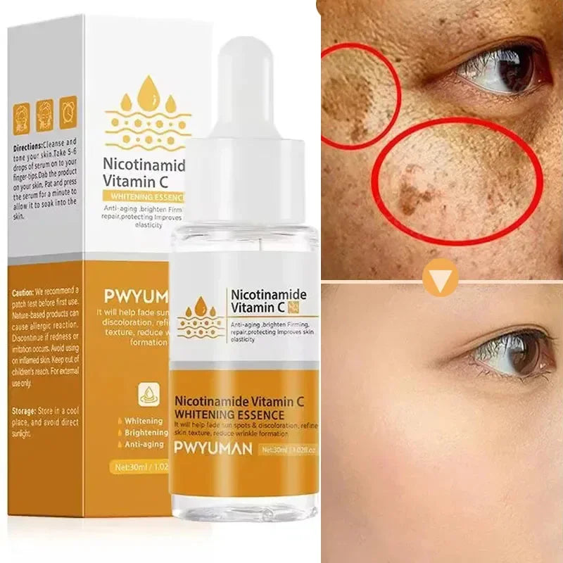 Nicotinamide Whitening Freckles Serum Dark Spot Remover Vitamin C Lightening Melanin Blemish Moisturizer Brighten Face Skin Care